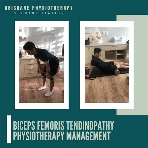 Biceps Femoris Tendinopathy Physiotherapy Management - Brisbane Physiotherapy