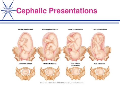 PPT - Normal Labor and Delivery Physiological Adaptations Chapter 17 PowerPoint Presentation ...