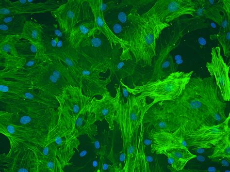 Rat Hepatic Stellate Cells - Innoprot Liver Cell System