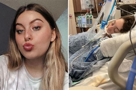 Teen goes on life support with lung damage — vaping habit to blame