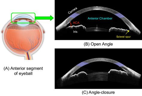 (A) AS-OCT image captures the anterior segment region of the eye ...