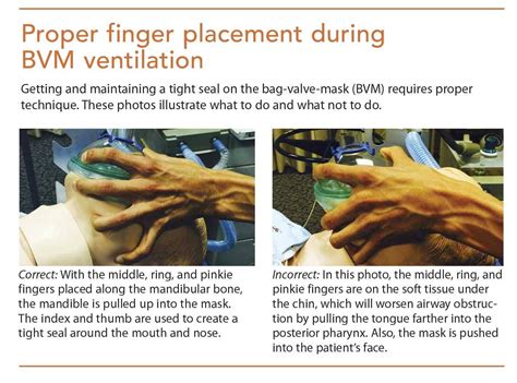 Pin by Andres Sanchez on CPR/ACLS | Illustration, Photo