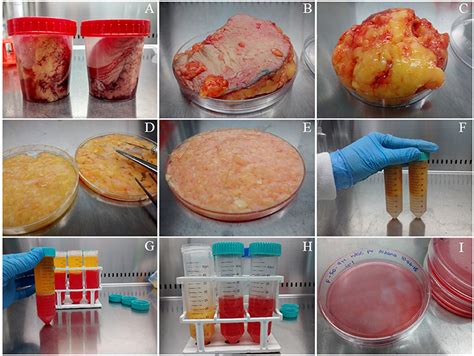 Frontiers | Human Adipose-Derived Mesenchymal Stem/Stromal Cells ...