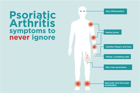 Psoriatic Arthritis Signs and Symptoms