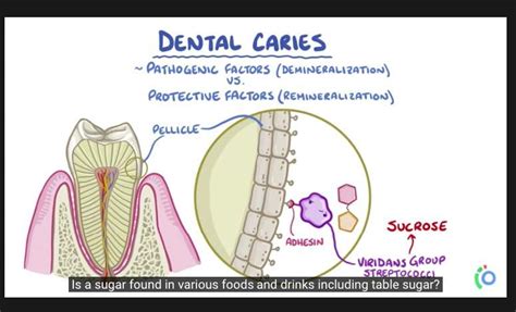 Is artificial milk harming your baby's teeth?