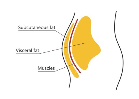 What is Subcutaneous Fat, and Can It Be Reduced At Home?