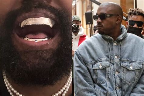 Kanye West spends almost 1 million dollars on titanium grill, did he remove all his teeth?