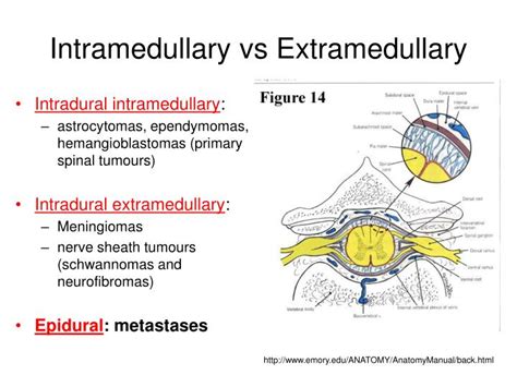 PPT - Spinal Cord Compression PowerPoint Presentation - ID:851177