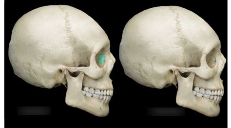 Lacrimal Bones Diagram | Quizlet