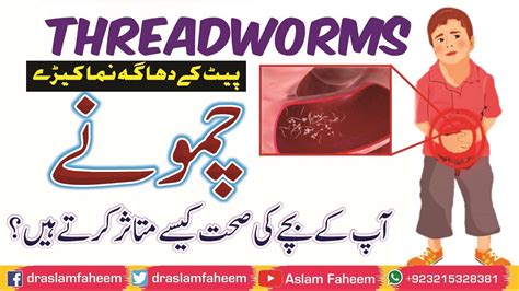 How To Get Rid of Pinworms / Threadworms | Causes, Symptoms and ...