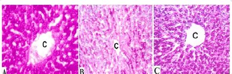 Photomicrographs of PAS-reacted liver sections showed A: control group... | Download Scientific ...