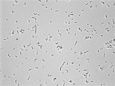 Bacterial Cells Under Microscope 400x