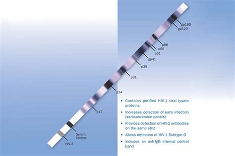 HIV Western Blot Assay 2.2, HIV testing — Sterilab Services Pathology ...