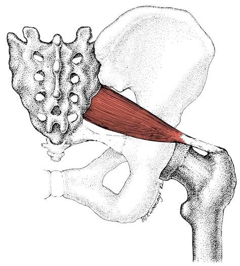 Thera-Band Exercises Effective for Piriformis Syndrome - Performance ...