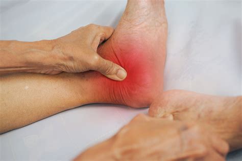 A New Treatment for Ankle Arthritis - myHealth bytes