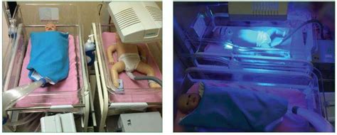 Phototherapy device for neonatal jaundice