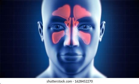 Nasal Sinus Infection Frontal Ethmoidal Sphenoidal: ilustración de stock 1628452270 | Shutterstock
