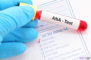 Antinuclear Antibody Test - (ANA) : Positive & negative test results ...