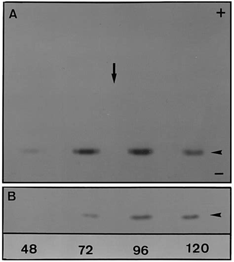 Peroxidase isoenzyme patterns obtained by NEIEF of cellular protein (A)... | Download Scientific ...