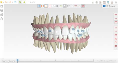 Spark™ Clear Aligners - Maryland Advanced Orthodontics | Gaithersburg MD