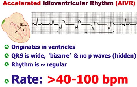 Ventricular rhythms