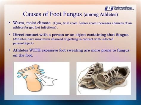 Foot Fungus in Athletes