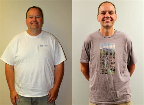 Kenneth's Weight Loss Before and After | St Louis Bariatrics