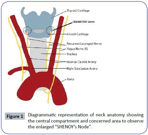 Recurrent Laryngeal Nerve In Thyroidectomy