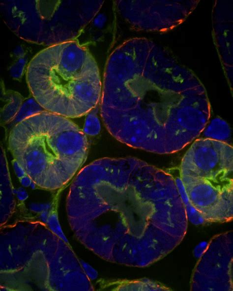 Advanced Light Microscopy Core | Nikon Spinning Disk Confocal