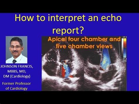 How to interpret an echo report? - YouTube