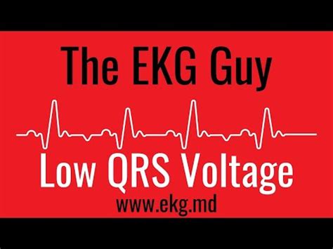 Low QRS Voltage on EKG / ECG l The EKG Guy - www.ekg.md - YouTube
