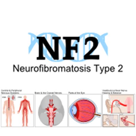 Neurofibromatosis Type 2 Gene