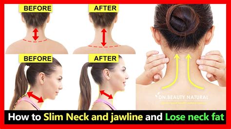 Get Beautiful Slim neck, Burn neck fat, Fix back neck fat hump | Neck ...