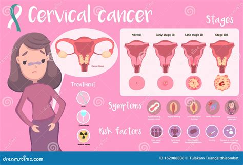 Cancer De Cervix