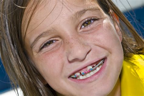 Expert Braces for Children: Austin TX Orthodontist