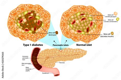 The pancreas has many islets that contain insulin-producing beta cells ...