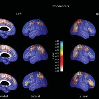 Cortical thickness analysis. | Download Scientific Diagram