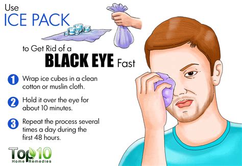 How to Get Rid of a Black Eye as Fast as Possible | Top 10 Home Remedies