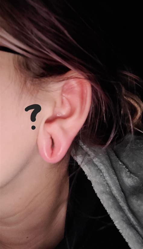 Ear lobe swollen? (posting details in comments because I have no idea how to use Reddit) : r ...