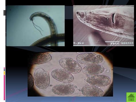 ANGIOSTRONGYLUS CANTONENSIS