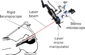 Current laryngeal laser surgery setup. | Download Scientific Diagram