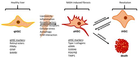 Biomedicines | Free Full-Text | Hepatic Stellate Cell Activation and Inactivation in NASH ...