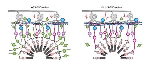 Improved retinal transplant technique ready for clinical trials - worldmedicinefoundation