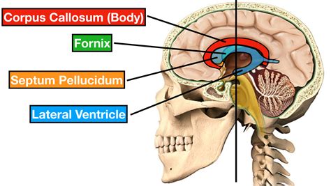 Lateral Ventricle Corpus Callosum