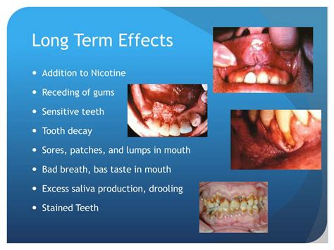 Side Effects of Tobacco: A Comprehensive Overview