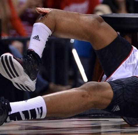 Kevin Ware Broken Leg One Of The Worst Injuries In Sports History- Warning Very Graphic ...