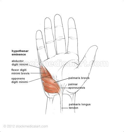 Thenar, Hypothenar Eminence, Colles/Smith Fracture Flashcards | Quizlet