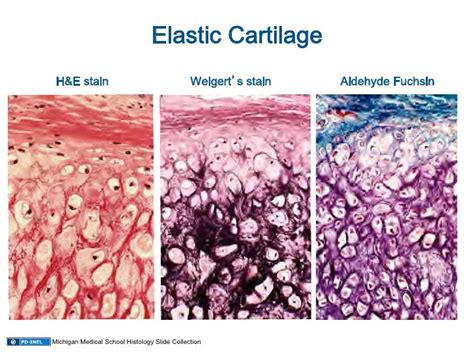 10.08.08: Histology - Cartilage/Mature Bone