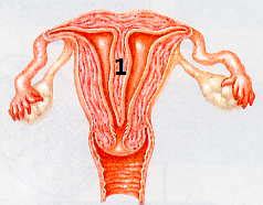 uterine septum, miscarriage, hysteroscopy, los ang - What is a uterine...