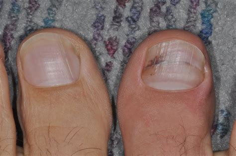 Foot and Ankle Problems By Dr. Richard Blake: September 2012